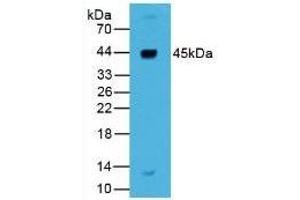 Detection of REN in Human Liver Tissue using Polyclonal Antibody to Renin (REN) (Renin Antikörper  (AA 67-153))