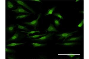 Immunofluorescence of monoclonal antibody to PRKCD on HeLa cell. (PKC delta Antikörper  (AA 577-676))