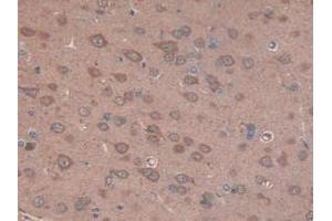 IHC-P analysis of Rat Brain Tissue, with DAB staining. (CS Antikörper  (AA 56-312))