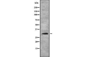 Western blot analysis FHL3 using HT29 whole cell lysates (FHL3 Antikörper  (Internal Region))