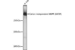 Western blot analysis of extracts of A-549 cells, using Cation-independent Cation-independent M6PR (IGF2R) (IGF2R) Rabbit mAb (ABIN1678848, ABIN3018066, ABIN3018067 and ABIN7101574) at 1:1000 dilution. (IGF2R Antikörper)