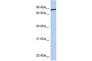 Junctophilin 1 antibody used at 1 ug/ml to detect target protein. (Junctophilin 1 Antikörper  (C-Term))