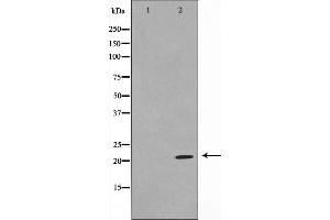 Western blot analysis on Jurkat cell lysate using TPD54 Antibody，The lane on the left is treated with the antigen-specific peptide. (TPD52L2 Antikörper  (C-Term))