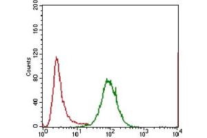 Immunohistochemical analysis of paraffin-embedded lung cancer tissues using IL3RA antibody with DAB staining. (IL3RA Antikörper  (AA 200-305))