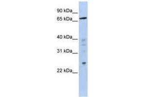 Image no. 1 for anti-Zinc Finger Protein 510 (ZNF510) (AA 611-660) antibody (ABIN6740579) (ZNF510 Antikörper  (AA 611-660))