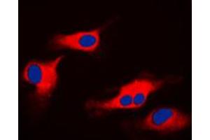 Immunofluorescent analysis of ORAOV1 staining in HeLa cells. (ORAOV1 Antikörper  (Center))