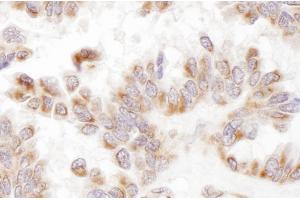 anti-Presenilin 2 (Alzheimer Disease 4) (PSEN2) (AA 275-325) antibody