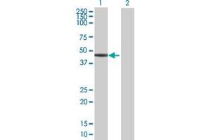 Western Blot analysis of SERPINB6 expression in transfected 293T cell line by SERPINB6 MaxPab polyclonal antibody. (SERPINB6 Antikörper  (AA 1-376))