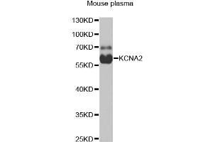 Western blot analysis of extracts of mouse plasma, using KCNA2 antibody. (KCNA2 Antikörper)