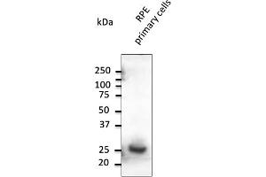 Western Blotting (WB) image for anti-RAB31, Member RAS Oncogene Family (RAB31) (C-Term) antibody (ABIN6254190) (RAB31 Antikörper  (C-Term))