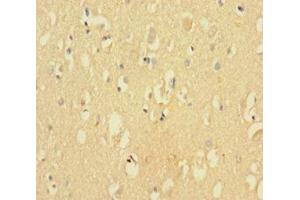 Immunohistochemistry of paraffin-embedded human brain tissue using ABIN7148873 at dilution of 1:100 (CDK2AP2 Antikörper  (AA 1-126))