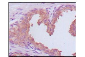 Immunohistochemistry (IHC) image for anti-Prostate Specific Antigen (PSA) (AA 26-251) antibody (ABIN2983296) (Prostate Specific Antigen Antikörper  (AA 26-251))