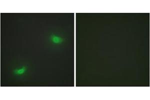 Immunofluorescence analysis of HepG2 cells, using DUSP16 antibody. (DUSP16 Antikörper  (C-Term))
