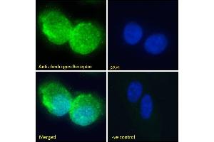 ABIN185266 Immunofluorescence analysis of paraformaldehyde fixed U2OS cells, permeabilized with 0. (Androgen Receptor Antikörper  (N-Term))