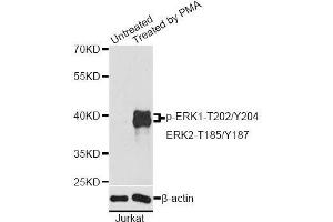 Western blot analysis of extracts of Jurkat cells, using Phospho-ERK1-T202/Y204 + ERK2-T185/Y187 antibody. (ERK1 Antikörper  (pThr185, pThr187, pThr202, pThr204))