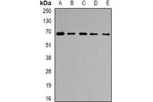 Western blot analysis of Ribophorin-2 expression in Jurkat (A), MCF7 (B), NIH3T3 (C), mouse liver (D), rat liver (E) whole cell lysates. (Ribophorin II Antikörper)