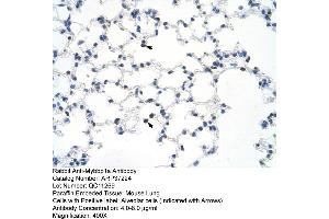 Mouse Kidney (MYBBP1A Antikörper  (C-Term))