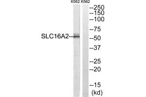 Western blot analysis of extracts from K562 cells, using SLC16A2 antibody. (SLC16A2/MCT8 Antikörper  (Internal Region))