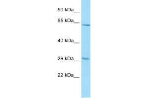 WB Suggested Anti-REEP3 Antibody Titration: 1. (REEP3 Antikörper  (C-Term))