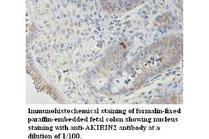 Image no. 1 for anti-Akirin 2 (AKIRIN2) antibody (ABIN1574568) (AKIRIN2 Antikörper)