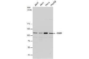 Western Blotting (WB) image for anti-alpha Ketoglutarate Dehydrogenase (alphaKGDHC) (C-Term) antibody (ABIN2856043)