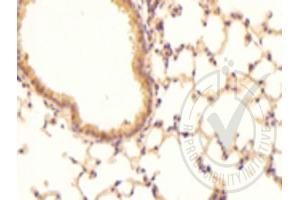 Immunohistochemistry (IHC) image for anti-Coagulation Factor III (thromboplastin, Tissue Factor) (F3) (AA 32-100) antibody (ABIN708086)