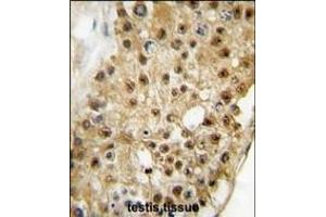 Formalin-fixed and paraffin-embedded human testis tissue reacted with ELP3 antibody (C-term) (ABIN387967 and ABIN2844715) , which was peroxidase-conjugated to the secondary antibody, followed by DAB staining.