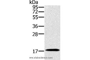 Western blot analysis of Mouse heart tissue, using RNF122 Polyclonal Antibody at dilution of 1:300 (RNF122 Antikörper)