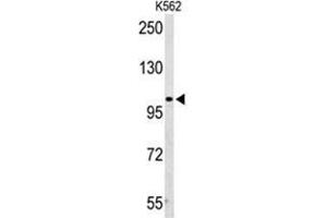 Western blot analysis of AMPD2 Antibody (Center) in K562 cell line lysates (35µg/lane).