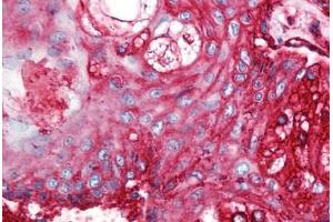 Human Skin, Pilosebaceous Unit (formalin-fixed, paraffin-embedded) stained with CD59 antibody ABIN298470 at 5 ug/ml followed by biotinylated anti-mouse IgG secondary antibody ABIN481714, alkaline phosphatase-streptavidin and chromogen. (CD59 Antikörper)