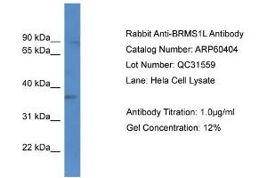 Western Blotting (WB) image for anti-Breast Cancer Metastasis-Suppressor 1-Like (BRMS1L) (C-Term) antibody (ABIN2788437) (BRMS1L Antikörper  (C-Term))