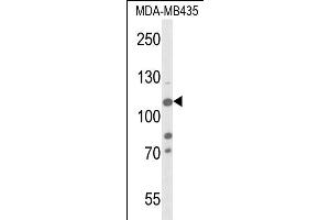 Western blot analysis of JMJD2B- (ABIN653576 and ABIN2842951) in MDA-M cell line lysates (35 μg/lane). (KDM4B Antikörper  (AA 281-306))