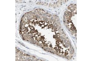 Immunohistochemical staining of human testis with KLHDC10 polyclonal antibody  shows strong cytoplasmic positivity in cells of the seminiferus ducts at 1:50-1:200 dilution. (KLHDC10 Antikörper)