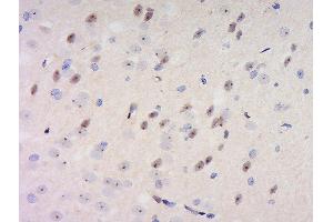 Formalin-fixed and paraffin embedded rat brain labeled with Anti-GDNFRA Polyclonal Antibody, Unconjugated  at 1:200 followed by conjugation to the secondary antibody and DAB staining. (GFRA1 Antikörper  (AA 351-429))