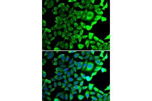 Immunofluorescence analysis of A549 cells using USP8 antibody (ABIN5974228). (USP8 Antikörper)