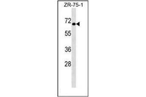 Western blot analysis of GTF3C5 Antibody (Center) in ZR-75-1 cell line lysates (35ug/lane). (GTF3C5 Antikörper  (Middle Region))