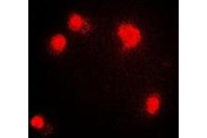 Immunofluorescent analysis of PRMT5 staining in HepG2 cells. (PRMT5 Antikörper)
