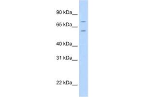 Western Blotting (WB) image for anti-Forkhead Box K1 (Foxk1) antibody (ABIN2461563) (Foxk1 Antikörper)