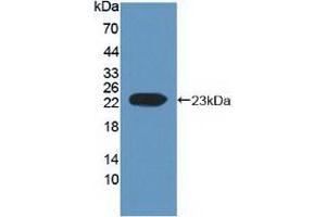 Western blot analysis of recombinant Human EFNA1. (Ephrin A1 Antikörper  (AA 19-182))