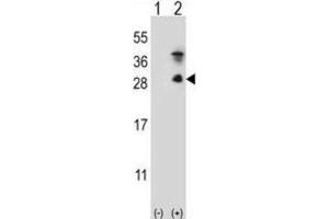 Western Blotting (WB) image for anti-Kallikrein 7 (KLK7) antibody (ABIN5022445) (Kallikrein 7 Antikörper)