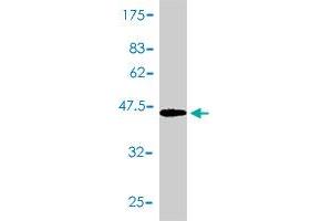 Western Blot detection against Immunogen (47. (PTGDS Antikörper  (AA 1-190))