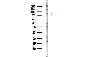 anti-Bromo Adjacent Homology Domain Containing 1 (BAHD1) antibody