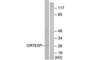 Western blot analysis of extracts from NIH-3T3 cells, using OR7E5P Antibody. (OR7E5P Antikörper  (AA 35-84))