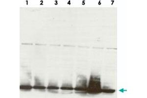 Western Blot analysis of different stages of the cell cycle (1) asynchronous population, (2)G1/Sa, (3)G1/Sb, (4)S phase, (5)G2/M, (6)M, (7)G1.