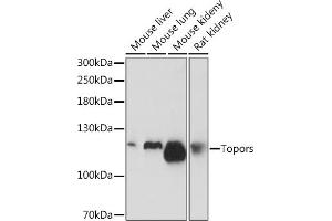 Western blot analysis of extracts of various cell lines, using Topors Rabbit pAb (ABIN7270855) at 1:1000 dilution.