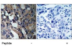Image no. 1 for anti-Heat Shock 27kDa Protein 1 (HSPB1) (Ser15) antibody (ABIN197345) (HSP27 Antikörper  (Ser15))