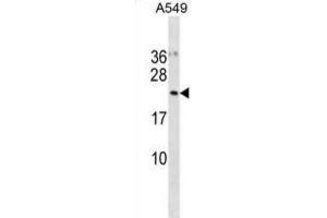 Western Blotting (WB) image for anti-Ubiquitin-Fold Modifier Conjugating Enzyme 1 (UFC1) antibody (ABIN3001127) (UFC1 Antikörper)