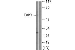 Western blot analysis of extracts from HepG2 cells, using TAK1 (epitope around residue 184) antibody. (TR4 Antikörper  (Thr184))