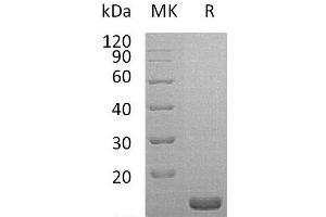 Western Blotting (WB) image for Interleukin 1 Receptor Antagonist (IL1RN) protein (ABIN7320549)