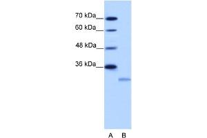 WB Suggested Anti-EIF4E2 Antibody Titration:  2. (EIF4E2 Antikörper  (N-Term))